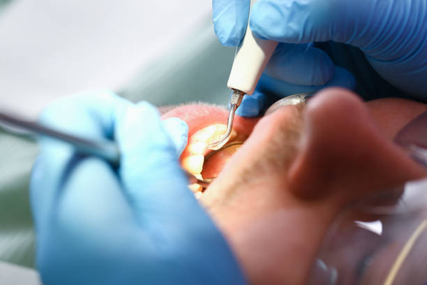 Best Emergency Dental Extractions in Bradley Gardens, NJ