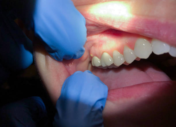 Best Holiday Emergency Dentist in Bradley Gardens, NJ